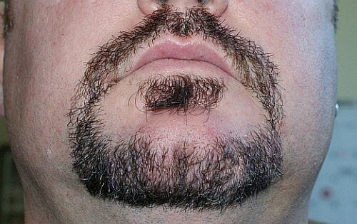 Goatee after using Harvest Moon natural beard dye